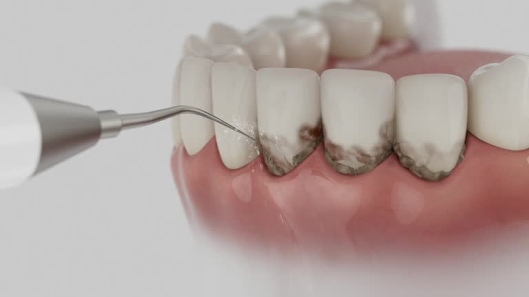 Trusted Tooth Extraction service in Town and Country, WA - Dentist Open Now
